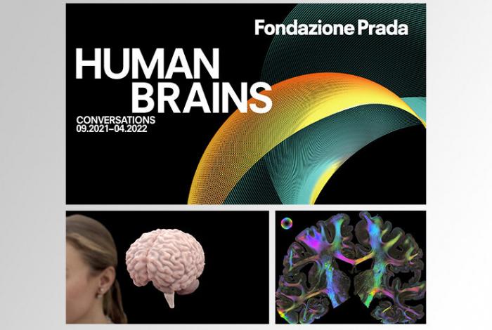 Human brains